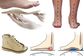 Chaussures orthopédiques pour hallux valgus chez un enfant